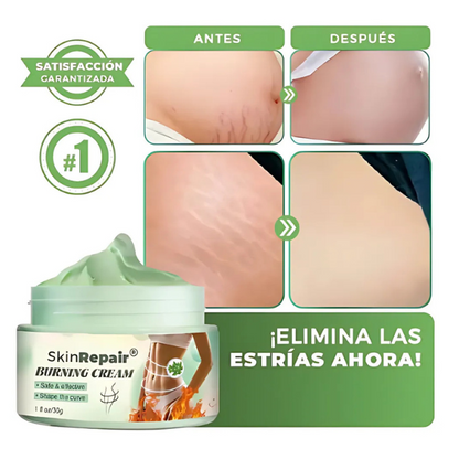 SkinRepair™ | Crema Reafirmante para el Cuerpo