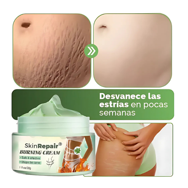 SkinRepair™ | Crema Reafirmante para el Cuerpo